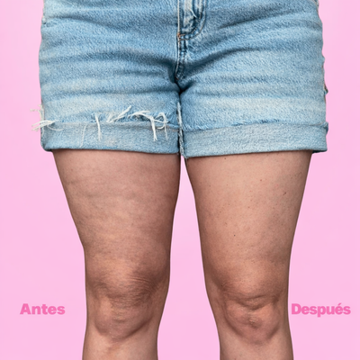 FLORUVI - Piernas, Glúteos y Abdomen